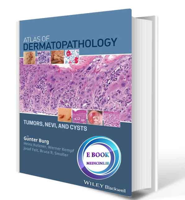 دانلود کتاب Atlas of Dermatopathology Tumors, Nevi, and Cysts 2019 (ORIGINAL PDF)